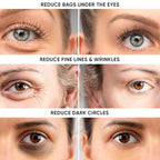 Instant Eye Tightener – Removes Under Eye Bags & Puffiness. Eliminate Dark Circles & Wrinkles. Naturally Ageless Hydrating Cream. Disappears Before Your Eyes Within Minutes.
