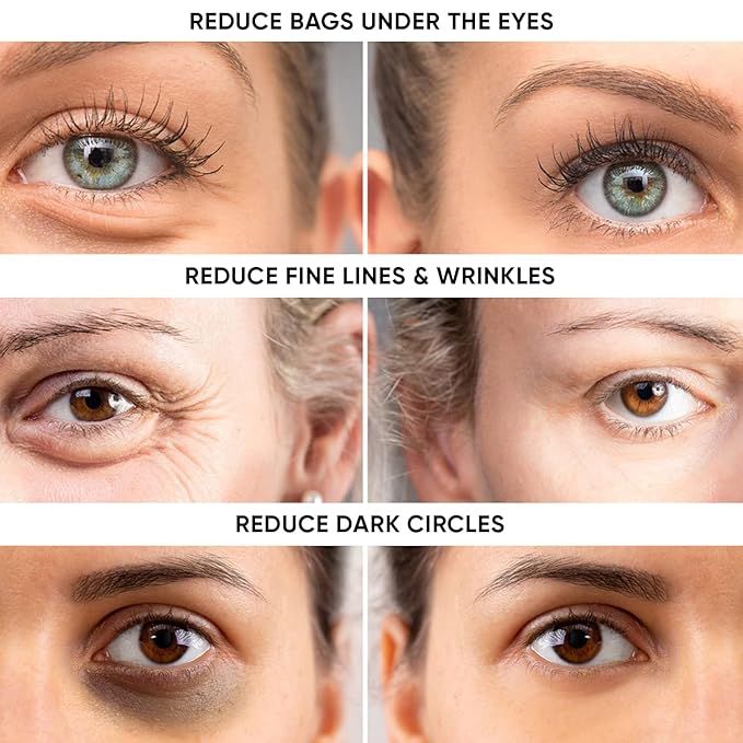 Instant Eye Tightener – Removes Under Eye Bags & Puffiness. Eliminate Dark Circles & Wrinkles. Naturally Ageless Hydrating Cream. Disappears Before Your Eyes Within Minutes.