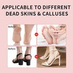 2025 Dermave Electric Foot Callus Remover for feet, ProfessionalPedicure Tool forDead Skin Removat, Best Electrie-Foot File for Women with 60 Sandpaper Discs for Soft Smooth feet