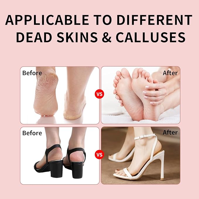 2025 Dermave Electric Foot Callus Remover for feet, ProfessionalPedicure Tool forDead Skin Removat, Best Electrie-Foot File for Women with 60 Sandpaper Discs for Soft Smooth feet