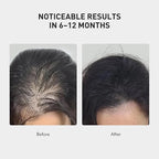 0.9% KX-826 KINTOR Hair Growth Spray,Strengthen Hair Nourish Hair follicles,Hair Care Products for Sparse Hair and Oily Hair Men&Women,60ml,Pro