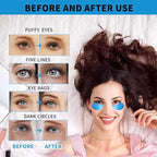 Under Eye Masks for Dark Circles and Puffiness 70PCS, Under Eye Patches for Puffy Eyes Treatment, Under Eye Gel Pads w/Collagen, Retinol, Hyaluronic Acid for Eye Bags Treatment, Gel Eye Mask Skincare