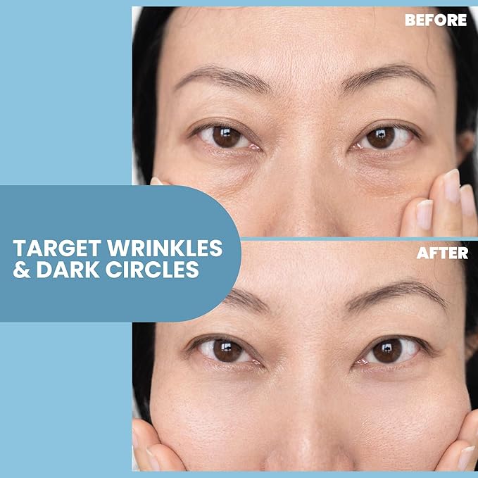 Eva Naturals Eye Gel for Dark Circles, Bags & Puffiness – Anti-Aging Serum with Peptides, Hyaluronic Acid & Botanicals – Firming Under Eye Treatment for Wrinkles, Fine Lines & Tired Skin – 2 oz 2 Pack