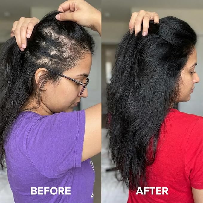 Hair Oil for Hair Growth – Botanical Rosemary Scalp in Glass Bottle with Castor Oil, Vitamin E, Coffee & Olive Oil – Natural Vegan Hair Growth Oil for Thinning Hair, Dry Scalp & Breakage