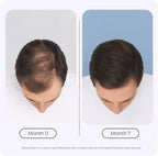 Complex10 Hair Support Supplement with Biotin, Collagen & 10 Essential Nutrients – Supports Healthy, Stronger-Looking Hair – 30 Capsules for Men & Women