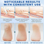 2Pack 60% Urea with 2% Salicylic Acid Urea Foot Care Stick, Foot Cream Moisturizer for Dry Cracked Feet, Knees, Elbows, Hands,Moisturizes and Hydrates the Dry Skin,Callus Remover & Skin Softener