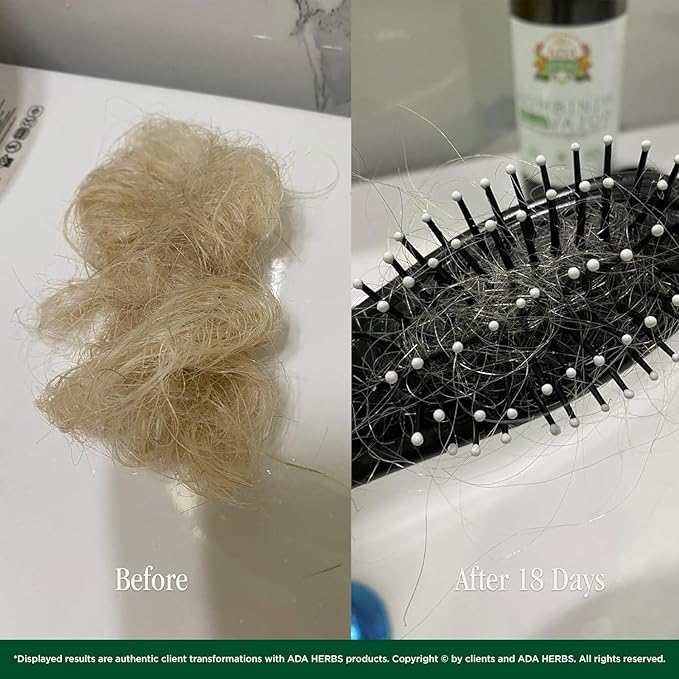 Hair Oil Mask Pre-Wash & Overnight 100% Natural Hair Growth Oil with Cold Pressed Argan, Castor, Jojoba, Rosemary, Vitamin E, Deep Conditioning for Dry Damaged Hair, Squalane from Olive (17.6 Fl Oz)