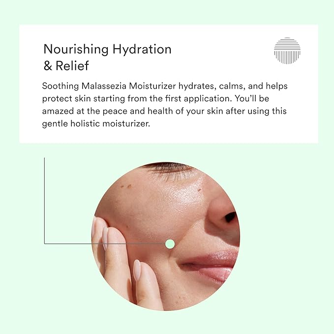 Malassezia Moisturizer, Soothe and Relieve, Safe for Folliculitis and Seborrheic Dermatitis, 2 fl oz