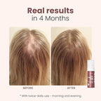 Trybello Hair Helper + Spray | Hair Growth Serum, powered by Capixyl | With Biotin, Castor Oil, Caffeine, Rice Water & Peptide Complex | Natural Treatment for Thicker, Fuller Strands | Vegan Formula