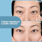 Eva Naturals Eye Gel for Dark Circles, Bags & Puffiness – Anti-Aging Serum with Peptides, Hyaluronic Acid & Botanicals – Firming Under Eye Treatment for Wrinkles, Fine Lines & Tired Skin – 1 oz