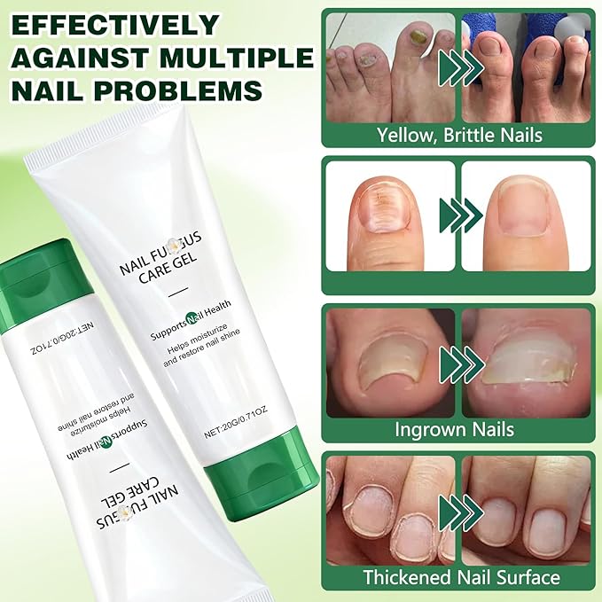 2PCS Nail Repair Gel, Nail Growth Repair Cream, New Multi-Purpose Nail Repair, Foot Care Cream for Moisturizing and Repairing Feet