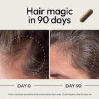 Moon Juice SuperHair Hair Growth Vitamins for Women & Men with Biotin & Saw Palmetto - Clinical Strength Multivitamin Hair Supplement for Healthier, Stronger, Thicker Hair, 120 Capsules - 30 Servings