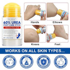2PCS Urea Cream Stick 60% plus 2% Salicylic Acid, Urea Foot Cream for Dry Cracked Heels, Foot Lotion Stick for Rough Thick Dry & Cracked Skin, Maximum Strength Moisturizer,Foot Moisturiser