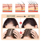 Hair Serum for Hair Loss & Thinning Hair | Hair Growth Oil for Men and Women, 1.05 fl.oz