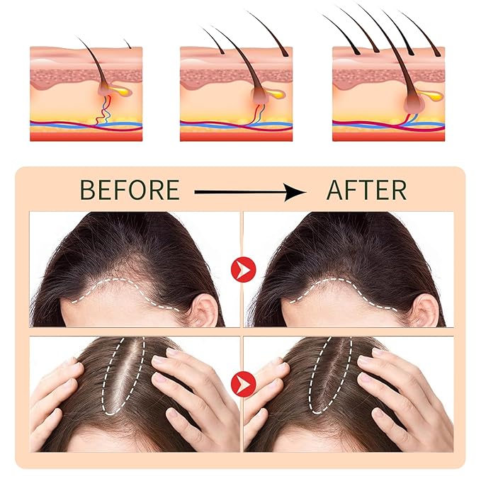 Hair Serum for Hair Loss & Thinning Hair | Hair Growth Oil for Men and Women, 1.05 fl.oz