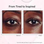 grace & stella Under Eye Brightener with Cooling Metal Rollerball - Ceramide & Caffeine Eye Cream for Puffy Eyes - Travel Size Toiletries - Vegan Skincare (15ml / 0.51floz)