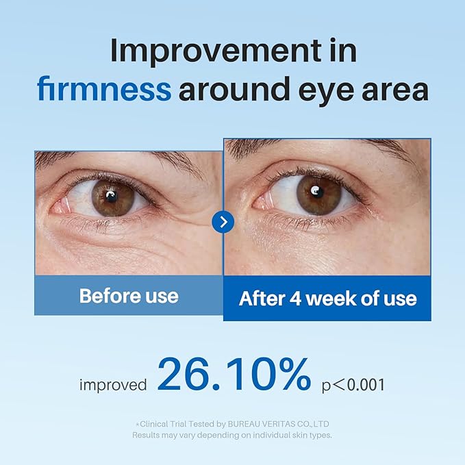 Caffeine Eye Cream, Under Eye Cream for Dark Circles, Puffiness & Puffy Bags, Wrinkles Fine Lines, Eye Roller Serum with 360° Massage Ball for Women and Men - 0.7 fl. oz