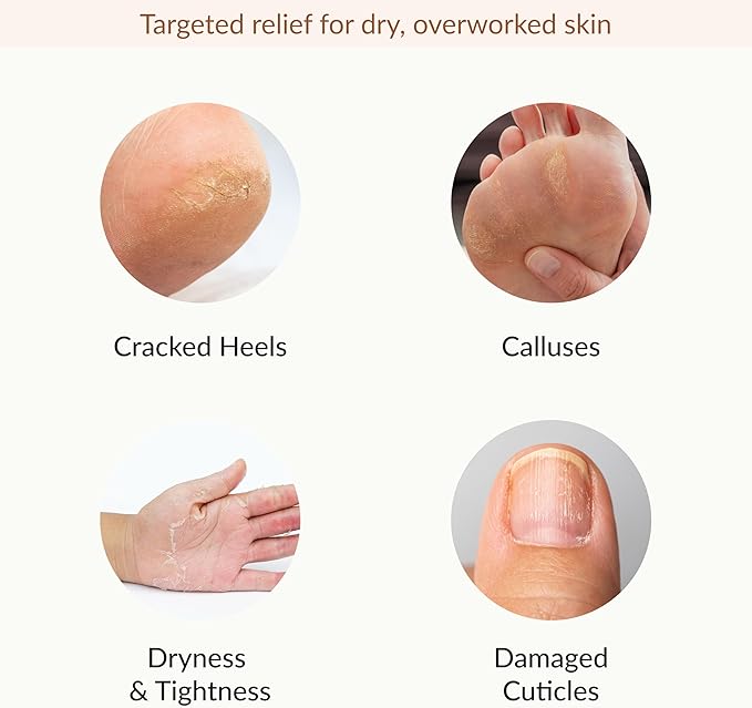 Epielle Hydrating & Moisturizing Hand & Foot Masks, Relieve and Soften Dry, Rough Skin, Self Care Gifts for Women, Spa Kit, Stocking Stuffers, 6 Moisturizing Gloves & 6 Moisturizing Socks