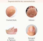 Epielle Hydrating & Moisturizing Hand & Foot Masks, Relieve and Soften Dry, Rough Skin, Self Care Gifts for Women, Spa Kit, Stocking Stuffers, 6 Moisturizing Gloves & 6 Moisturizing Socks