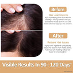Ultra Restore Hair Growth Serum -Promote Fuller Hair Growth and Reduce Hair Loss, Nurtures Hair Follicle, Hydrates the Scalp, Detox Scalp -Stem Cells, Ashwagandha, Biotin, Keratin