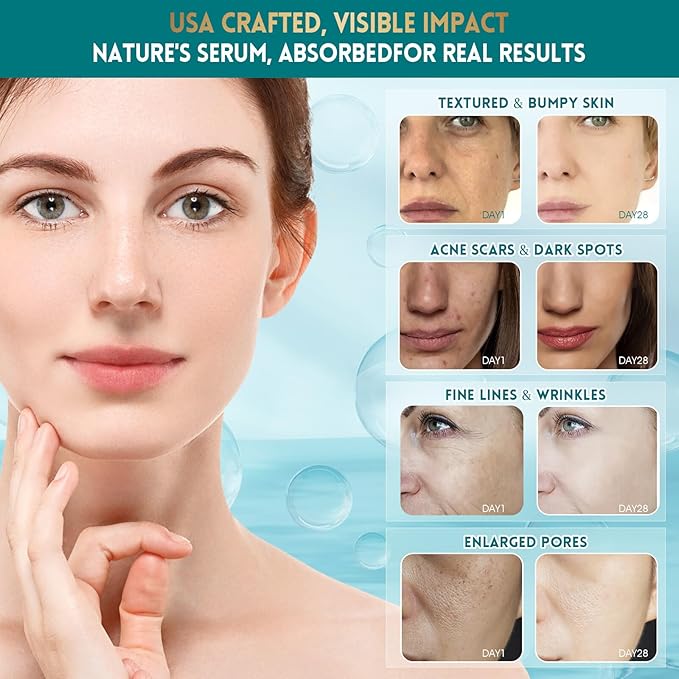 Snail Mucin Face Serum with Hyaluronic Acid – Anti-Aging Facial Serum for Fine Lines, Wrinkles & Dull Skin – Hydrating & Firming Essence for All Skin Types, 1.18 fl oz