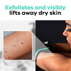 Dermasuri - Deep Exfoliating Glove - Korean Exfoliating Mitt - Body Scrubber for Shower - Buffs Dry & Dead Skin - Keratosis Pilaris Treatment Scrub - Stocking Stuffer Gifts for Women & Men - Teal Mitt