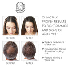 Hair Growth Serum- Maximum Strength DHT Blocker. Repairs & Stimulates New Follicle Hair Growth. Grow Stronger, Thicker, Fuller, Longer, Healthier Looking Hair. For Men & Women with No Side Effects.