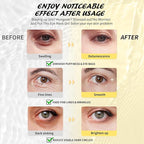 Under Eye Patches(8 Pairs), 24K Gold, Caffeine, Hyaluronic Acid, Aloe Vera Eye Masks for Dark Circles Puffy Eyes Undereye Bags, Eye Skin Care Gift Set for Bachelorette Party Favors