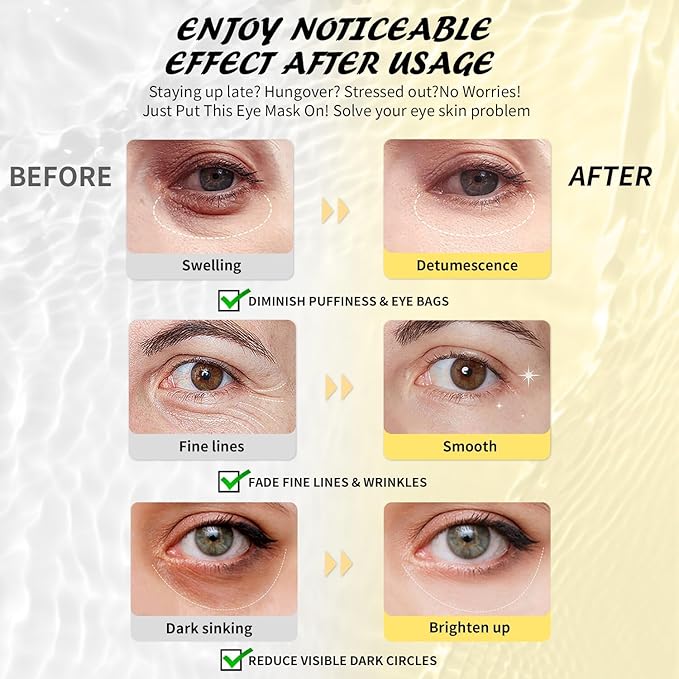 Under Eye Patches(8 Pairs), 24K Gold, Caffeine, Hyaluronic Acid, Aloe Vera Eye Masks for Dark Circles Puffy Eyes Undereye Bags, Eye Skin Care Gift Set for Bachelorette Party Favors