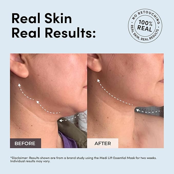 Essential Mask - Medi Lift EMS Facial Toning Device, FDA Cleared, Hands-Free Skin Device