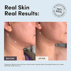 Essential Mask - Medi Lift EMS Facial Toning Device, FDA Cleared, Hands-Free Skin Device