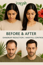 Inayah Ayurvedic Hair Oil for Hair Growth - 200ml | With Coconut Oil, Bhringraj, Amla, Hibiscus & 30+ Natural Herbs | Anti Hair Fall | Hair Regrowth Oil | No Fillers & Paraben Free