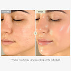 TOSOWOONG Real Collagen Face Serum, Hydrating & Firming Serum with hydrolyzed collagen, Hyaluronic Acid, Plumps, Sagging Skin, Reduces Fine Lines and Wrinkles, Korean Skincare, 33ml / 1.11 fl. oz.