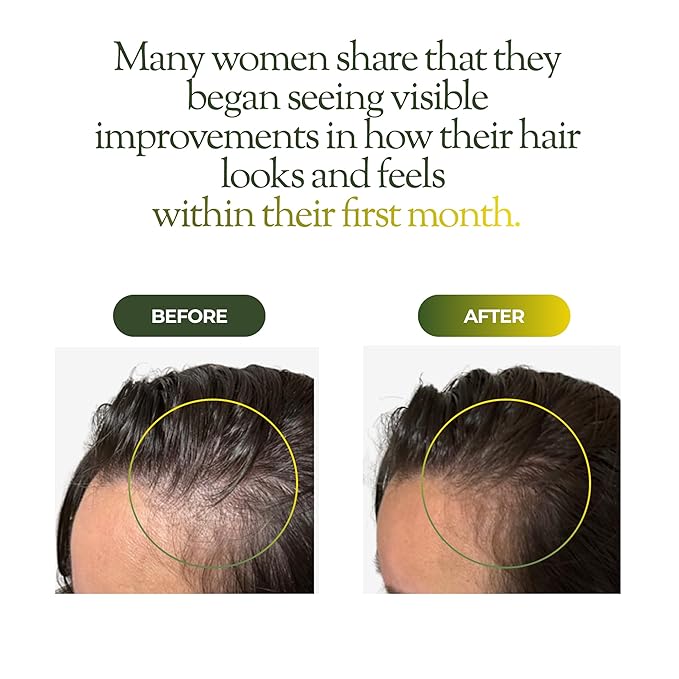 regener8 Hair & Scalp Oil for Women – Essential & Carrier Oil Blend for Hormone-Related Thinning & Loss – Natural Support for Postpartum, Menopause & Chronic Stress