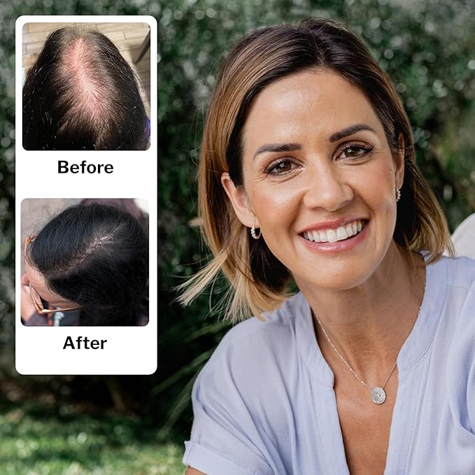 Shapiro MD Hair Growth Experts Women's Regrowth Kit Plus: Shampoo, Conditioner, 2% Minoxidil, Leave-In Foamer. Anti Hair Loss and Thinning Hair Solution for Women, 1 Month