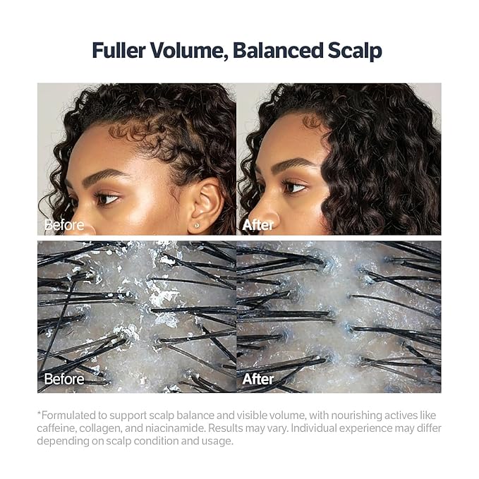 SUNGBOON EDITOR Deep Collagen Retinol Scalp Serum |Roll-On Hair Growth&Thickening Serum |Dry, Itchy Scalp Treatment |Caffeine +Biotin +Rosemary |Stocking Stuffers for Women |Korean Hair Care,0.5 fl oz