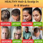 REVATOLOGY Hair Growth Oil for Adults (Made in USA) pre-rinse Formula with 30 Oils and Herbal extracts Reduces Hair Fall, Boosts Regrowth & Strengthens Roots | Cruelty & Chemical Free