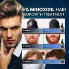 5% Minoxidil Hair Growth for Men and Women: Biotin Hair Growth Serum for Beard & Hair Loss, Thinning, and Faster Regrowth Treatment - 60ML