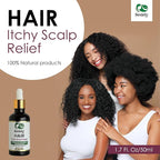 Seddy Itchy Scalp Relief Hair Oil - Scalp Treatment Oil, Instant Soothe, Anti Dandruff with Tea Tree & Peppermint Oil - Relieve Itchy, Dry Scalp - All Hair Types -For Men, Women, & Kids -1.7 Fl. Oz