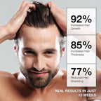 Root Activator Shampoo for Men: Hair Growth Shampoo for Hair Loss and Thinning Hair - 10.1 fl oz / 300 mL