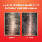 HAIRtamin Advanced Formula Hair Growth Supplement for Women & Men, Supports Stronger, Longer, Visibly Thicker Hair, With 5000 mcg Biotin, Vitamins & Antioxidants, 100% Vegan – 3 Month Supply