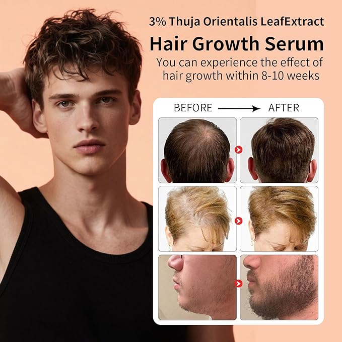 Hair Serum for Hair Loss & Thinning Hair | Hair Growth Oil for Men and Women, 1.05 fl.oz