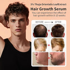 Hair Serum for Hair Loss & Thinning Hair | Hair Growth Oil for Men and Women, 1.05 fl.oz