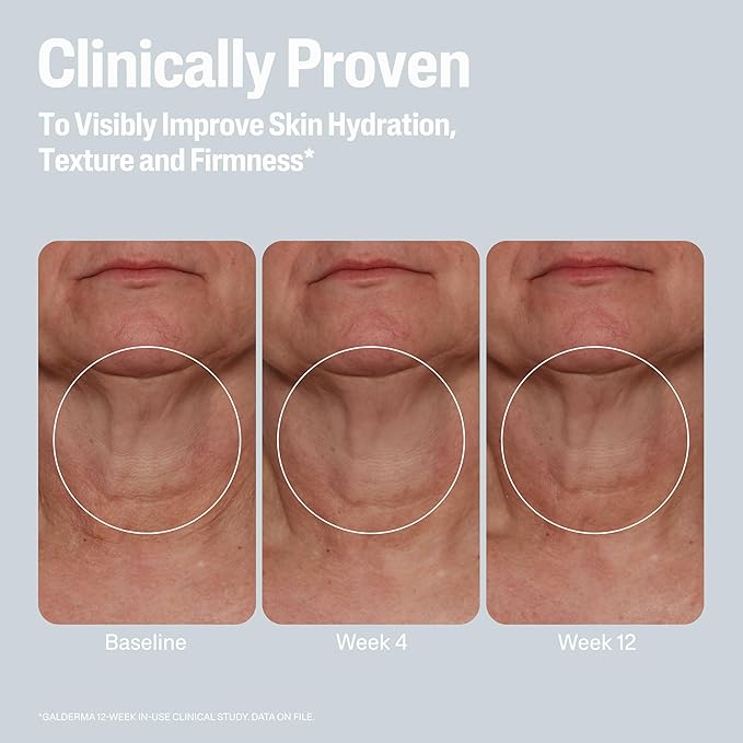 Cetaphil Skin Activator Hydrating & Firming Body Cream 12oz, Mandelic Acid (AHA) and Centella Asiatica (CICA) Cream, Hydrates and Firms Aging Skin, Anti-Aging Skincare, 12 oz