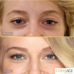 Jerome Alexander CoverAge Concealer Stick - Anti-Aging Under Eye Concealer + Skincare - Brighten Dark Circles, Hydrate, and Nourish - Medium Dark