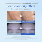 medicube Zero Exosome Shot 25,000 PPM Spicule Facial Serum | Liquid Skin Booster Serum | Exosome, AHA+BHA+PHA | Pore Care, Dead Skin Cells, Skin Texture | Korean Skin Care 0.43 fl.oz