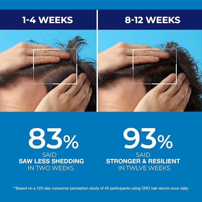 Biotin Hair Growth Shampoo for Men: Powerful Cleaning, Thickening & Strengthening Formula for Hair Loss & Thinning Hair, DHT-Blocking Root Activator with Biotin, Caffeine & Tea Tree Oil, 13.5 fl oz