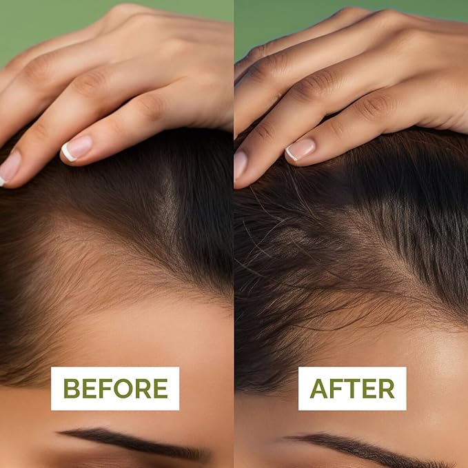 Just Nutritive Rosemary & Onion Hair Growth Oil Treatment for Thinning, Breakage, Scalp Health, Collagen Boost, Antioxidants, Omega-3 & 6 Fatty Acids for Stronger, Thicker Hair - 1 oz