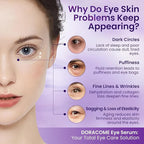 Caffeine & Retinol Eye Serum – Hydrating Under Eye Serum to Help Reduce the Appearance of Dark Circles & Puffiness and Smooth the Look of Fine Lines, 0.7 fl oz