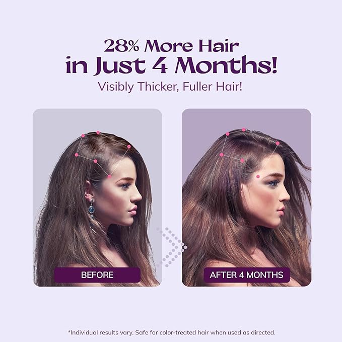 5% Minoxidil Spray for Women Hair Growth: RootStim Extra Strength Hair Regrowth Treatment with Biotin, Caffeine & Peptides for Thinning Hair, Fuller & Healthier Hair - 2 Fl Oz